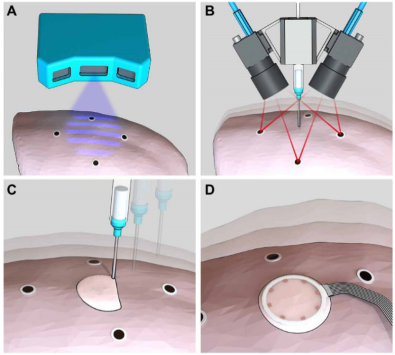 《Science》子刊：在活體器官上原位3D打印可變形水凝膠傳感器！