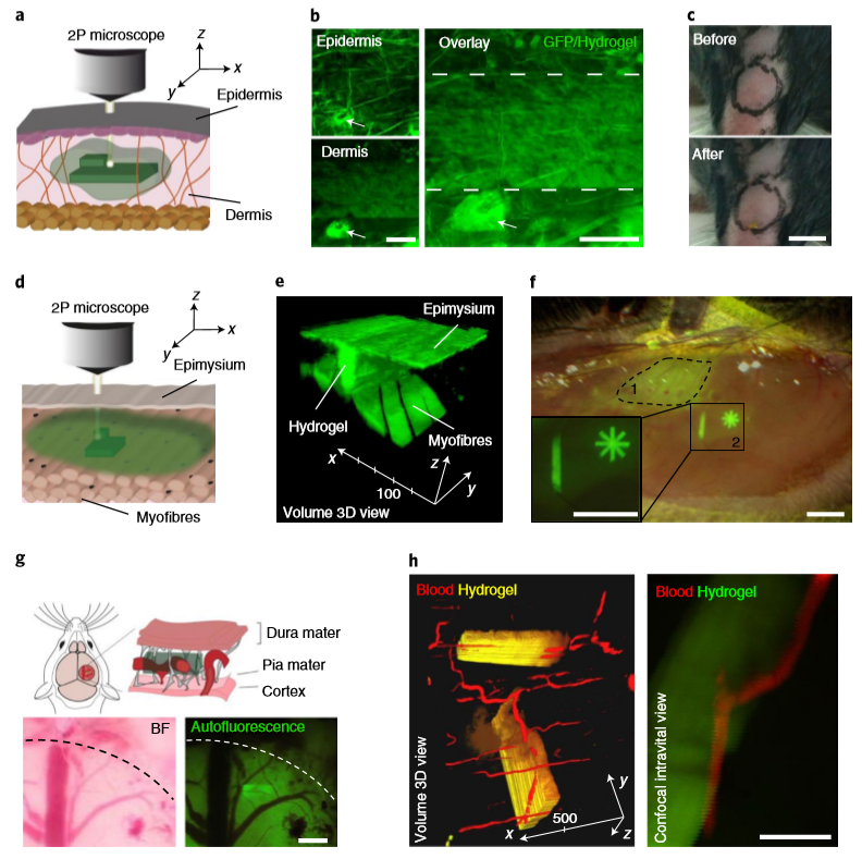 ?《Nat.Biomed.Eng.》:活體3D生物打印光敏聚合物水凝膠！有望代替常規(guī)生物打印